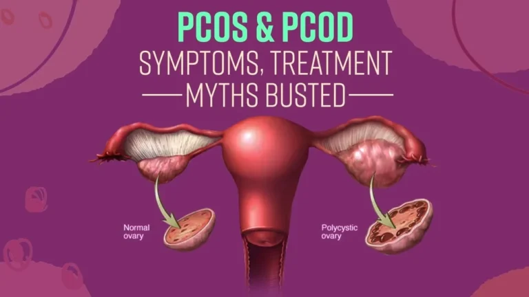 PCOS Treatment Without Medicine: Diet, Exercise & Lifestyle PCOS treatment without medicine